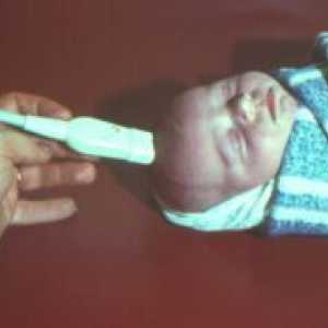 Intrakranijalni tlak u novorođenčadi