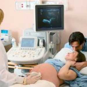 Drugi ultrazvuk u trudnoći