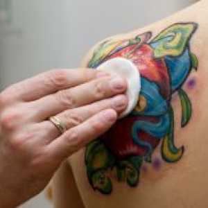 Tetovaža ozdravljenja