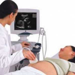 Žuto tijelo na ultrazvuku