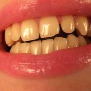Žute zube
